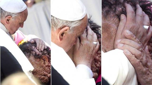 El Papa abraza a un hombre afectado por neurofibromatosis