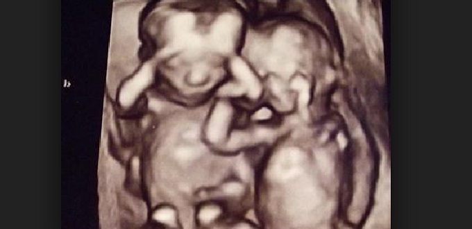 Madre embarazada de gemelos abandona una clnica abortista tras cambiar de opinin