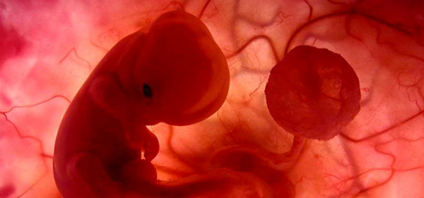 Mercado de Planned Parenthood: corazones, pulmones e hígados intactos de fetos abortados