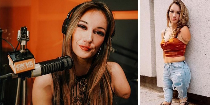 Charlie Rousseau, dispacitada tras sobrevivir a un aborto, es hoy una popular locutora de radio