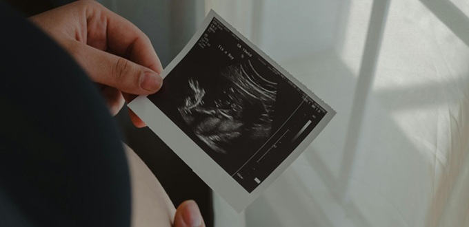 En California, 183.720 bebés fueron asesinados en abortos el año pasado En California, 183.720 bebés fueron asesinados en abortos el año pasado