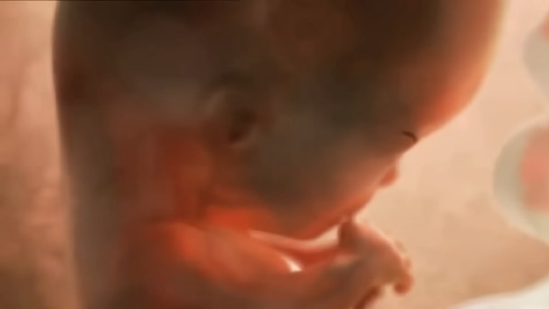Doscientas madres defienden la reversi�n de la p�ldora abortiva frente al intento de California de prohibirla